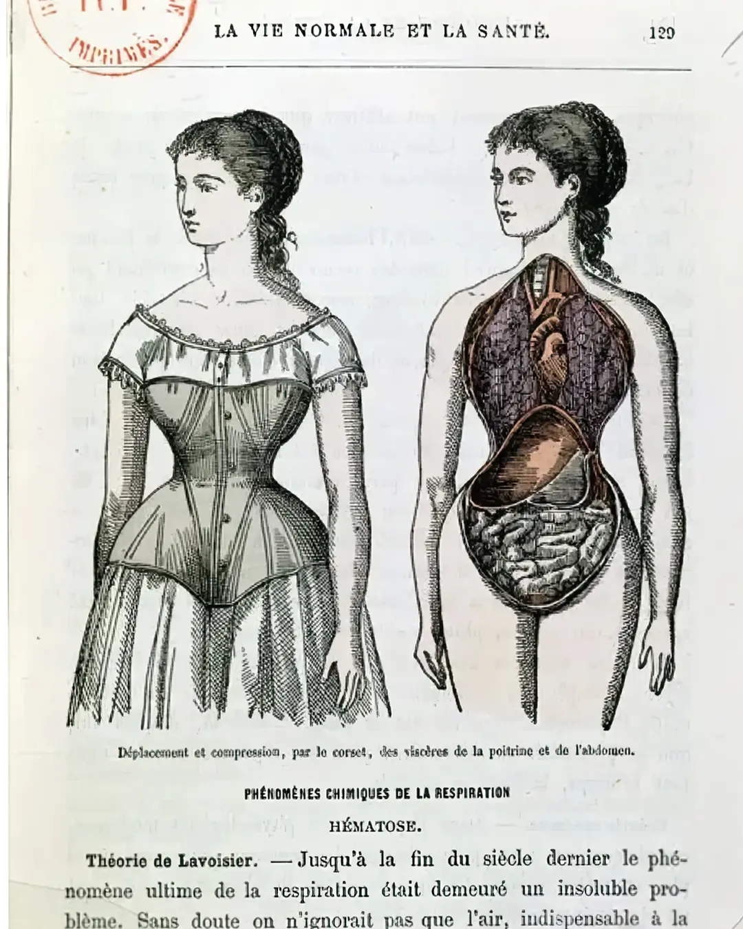 Corsets not a death sentence: study